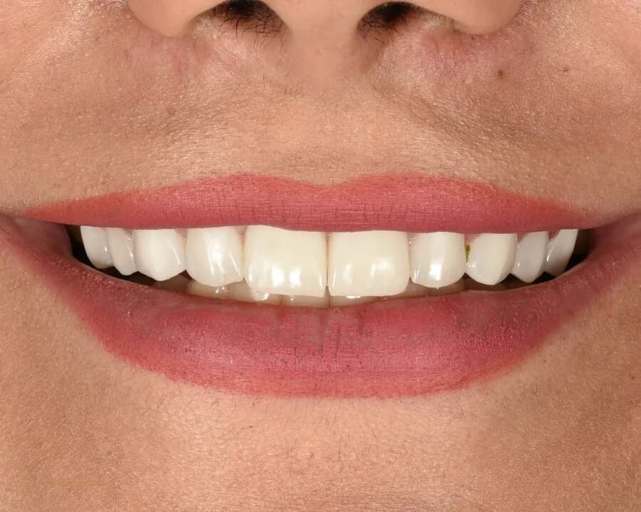 نمای نزدیک از لبخند بیمار